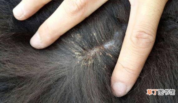 头上长虱子怎么去除 去虱子和虱子卵的有效方法