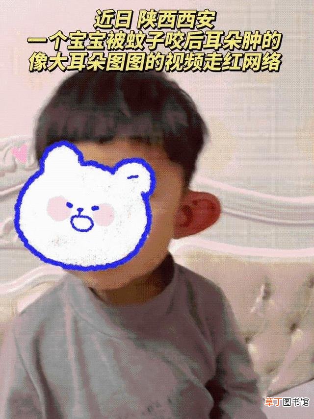 宝宝被蚊子咬了怎么消肿止痒最快 萌娃耳朵被蚊子叮成大耳朵图图