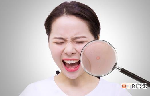 脸上长痘痘究竟是什么原因导致的