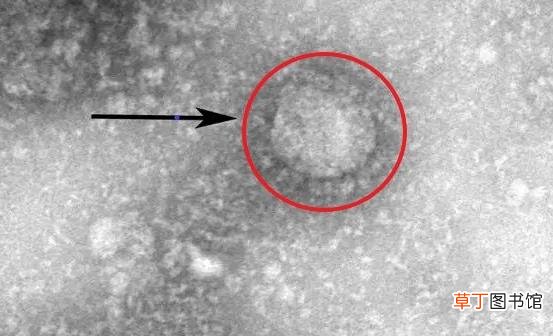 预防新冠病毒忌口有四 家里勤消毒助力抗疫早日成功