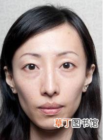打瘦脸针的三大副作用 打瘦脸针有什么危害
