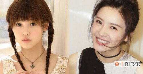 杨子珊整容前后照片对比,很明显卧蚕都整没了