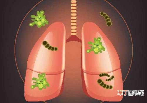肺气肿吃什么药最有效-肺气肿吃什么药效果好