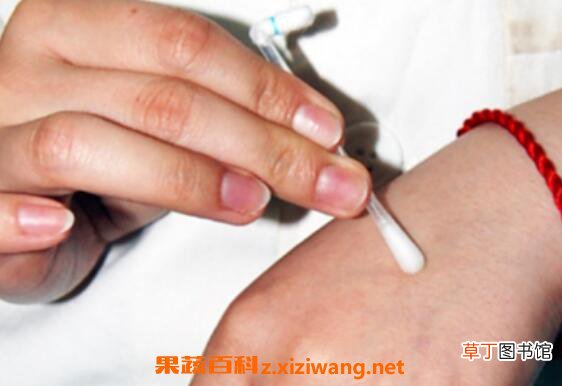 被蜜蜂蛰了怎么消肿快 蜜蜂蛰消肿的最快方法