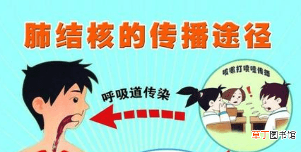 肺结核患者的平均寿命是多少-肺结核患者的平均能活多久