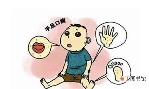什么是手足口病？手足口病怎么治疗