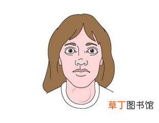 甲亢是什么病-甲亢是一种什么病