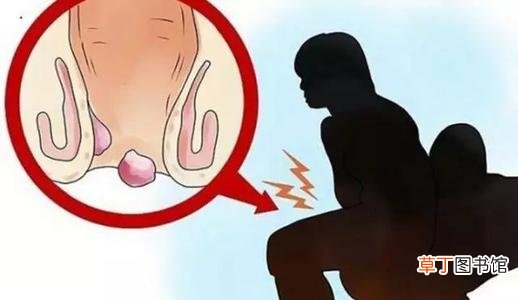 肛门坠胀吃什么药好-肛门坠胀需要吃什么药