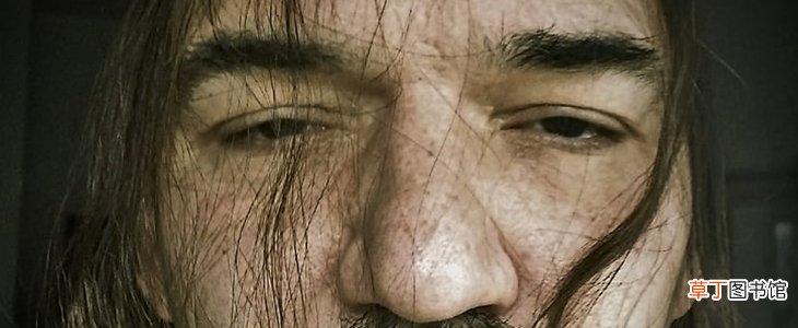 鼻子毛孔粗大怎么办