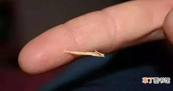 手上扎进刺怎么办-手上扎进刺弄不出来怎么办