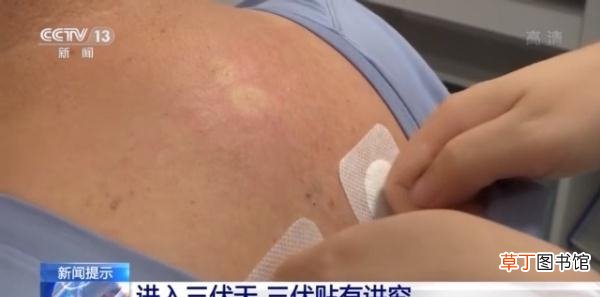 女人贴三伏贴有什么好处呢 三伏贴怎么贴