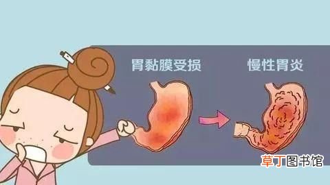慢性胃炎吃什么药好-治疗慢性胃炎的特效药有哪些