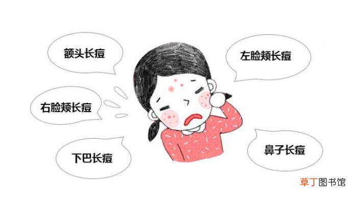 熬夜长痘痘后祛痘方法