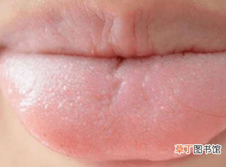 舌苔发黑是怎么回事呀-舌苔发黑是是因为什么
