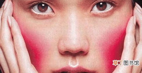 脸发热发红是什么原因-脸发热发红怎么回事