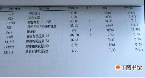 血常规哪个指标看贫血-血常规哪个指标看贫血最准确