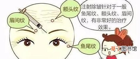 去皱针对皮肤有伤害吗