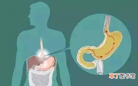 胃窦炎有哪些症状-什么症状表示得了胃窦炎