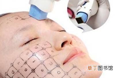 热玛吉副作用和危害都有哪些
