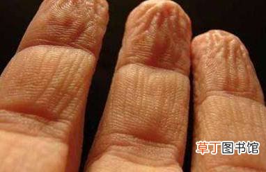 手洗了水起皱纹怎么办