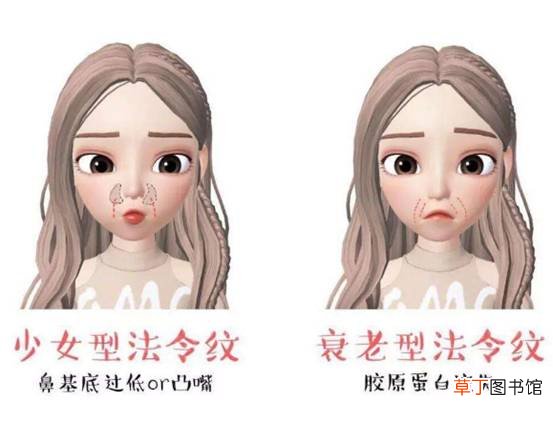 为什么年纪小就有法令纹