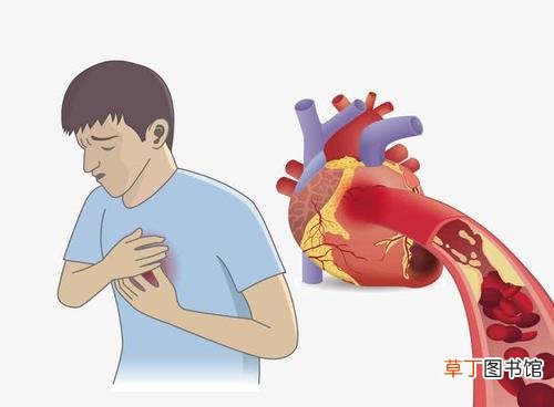 心肌梗塞是怎么引起的-怎么才回引起心肌梗塞
