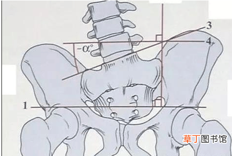 屁股的骨头痛怎么回事-屁股的骨头痛什么原因