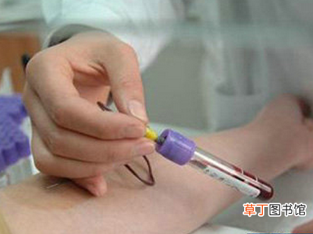 血常规检查什么的 血常规检查什么