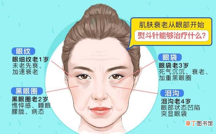 嗨体填充泪沟维持多久