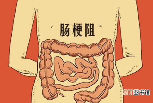 什么是肠梗阻-肠梗阻的症状