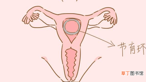女人取环的最佳年龄-女人取环的最佳年龄介绍