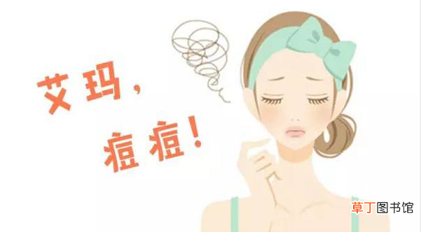 祛痘小妙招