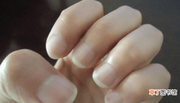 哪种指甲是癌症前兆-癌症前期指甲有什么变化