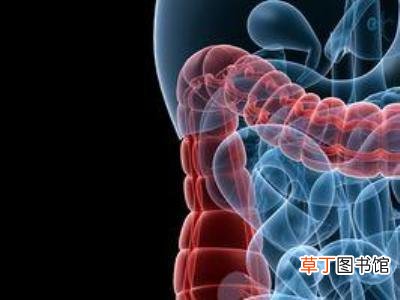 直肠癌早期的5大症状-直肠癌早期有哪5大症状