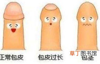 割包皮费用大概多少-割包皮需要多少钱