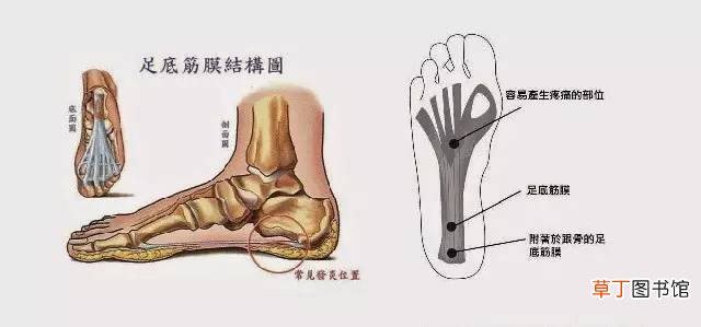 筋膜炎症状-筋膜炎症状有哪些