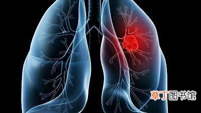 肺癌的中药治疗方法是什么-肺癌的中药治疗方法有哪些