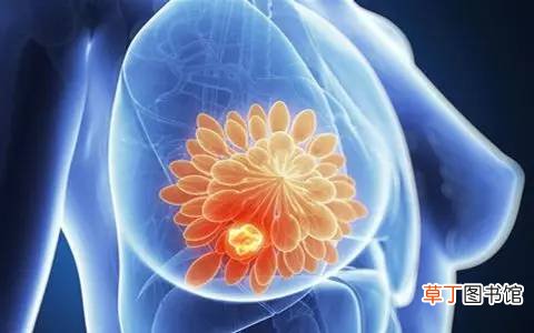 乳腺增生结节怎么消除-乳腺增生结节快速的消除方法
