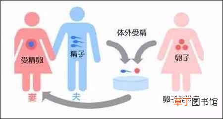人工授精和试管婴儿是一回事吗，二者有何区别?