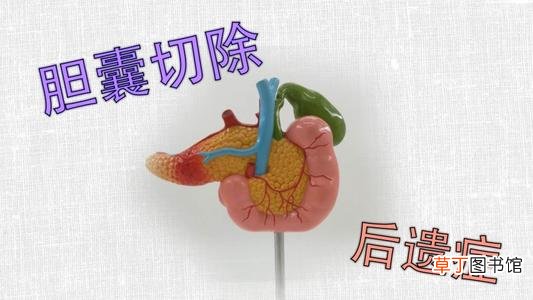 胆摘除后遗症是什么-胆摘除后遗症有哪些