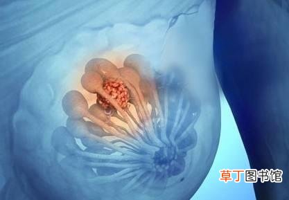 乳腺结节4a一定手术吗-乳腺结节4a一定要做手术才可以吗