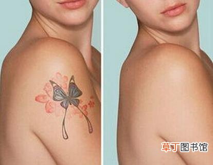 做一次皮秒洗纹身多少钱？洗纹身什么方法最有效