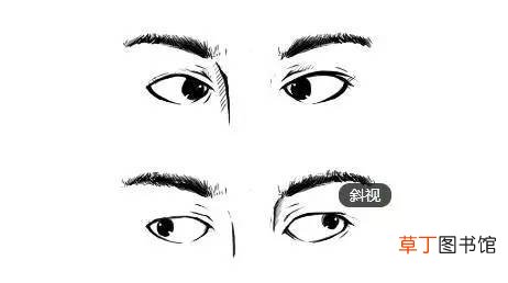 眼睛斜视手术多少钱-斜视手术大概需要多少钱