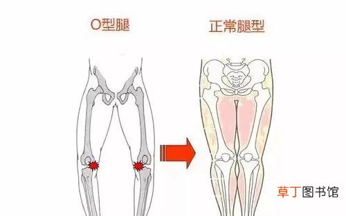 大腿根部与胯连接处疼怎么回事-导致大腿根部与胯连接处疼的原因有哪些