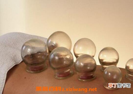 如何拔火罐 什么样的人需要拔血罐