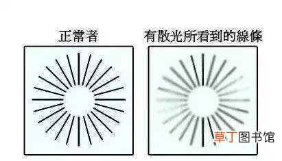 散光怎么恢复-怎么才能治疗散光