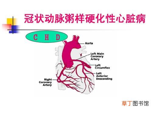 冠状动脉斑块能消除吗-冠状动脉斑块能不能消除