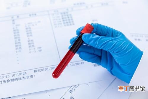 血常规各项指标的意义-血常规各项指标代表什么意思
