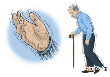 帕金森临终前几天有什么症状-帕金森临终前的症状