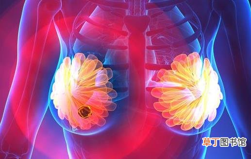 乳腺结节对女性危害大 乳腺结节形成的原因及预防